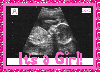 Sonogram- It's a Girl!